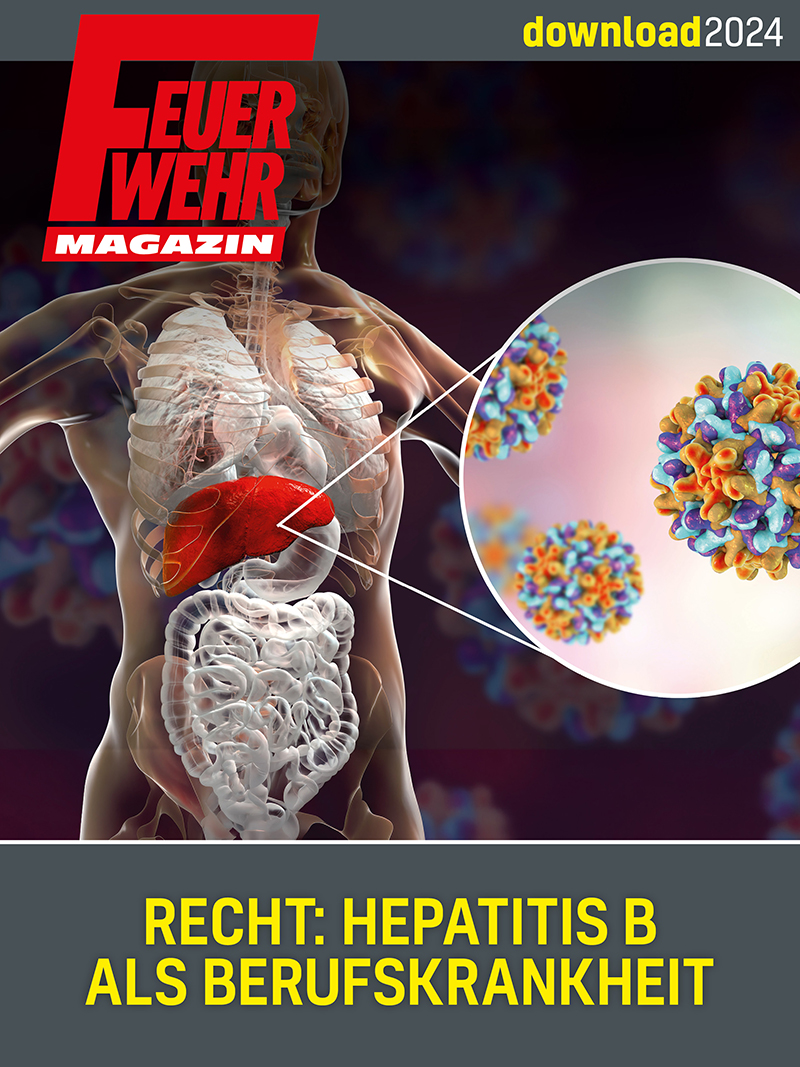 Produkt: Download: Recht – Hepatitis B als Berufskrankheit